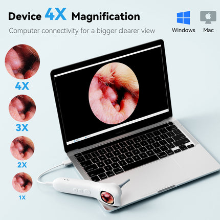 Electric Ear Cleaner with 1080P Camera – IP67 Otoscope with Screen, USB Rechargeable Ear Wax Removal Tool